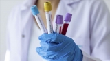 Bilant coronavirus! Câte cazuri s-au înregistrat în ultimele 24 de ore