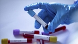 Bilanț coronavirus! Câte noi cazuri s-au înregistrat în ultimele 24 de ore