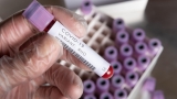Bilanțul cazurilor de coronavirus  înregistrare în ultimele 24 de ore în România