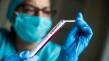În ultimele 24 h s-au înregistrat 9.187 cazuri noi de COVID-19 și 301 de decese 